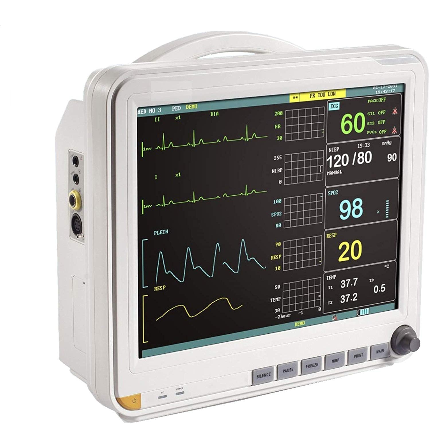 Cardiac Monitor